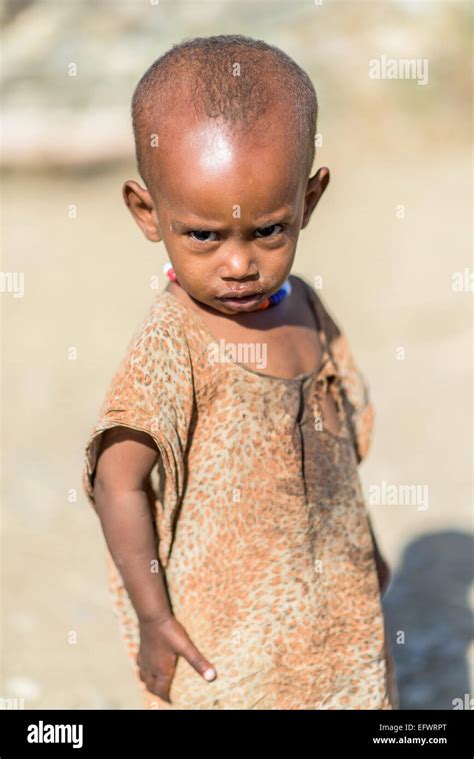 ethiopian skinny|skinny ethiopian child.